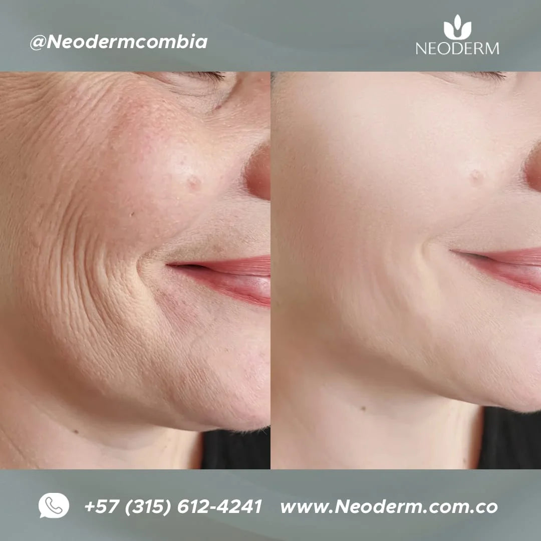 Ronas Serum Células Madre