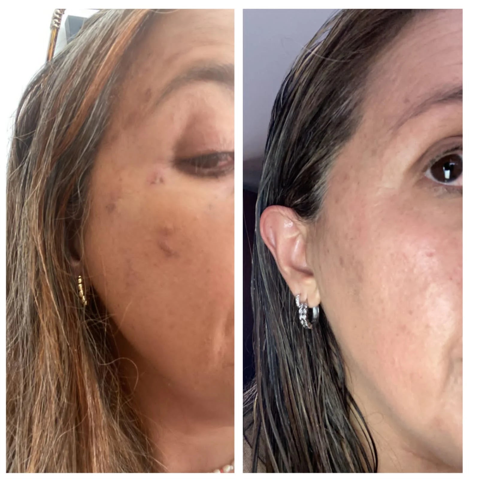 Ronas Serum Células Madre